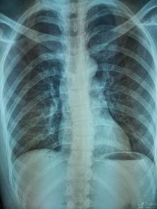 成人脊柱调理手法视频,专业指导,轻松掌握健康之道